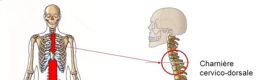 La Bosse De Bison Que Tous Redoutent Alinea Sante